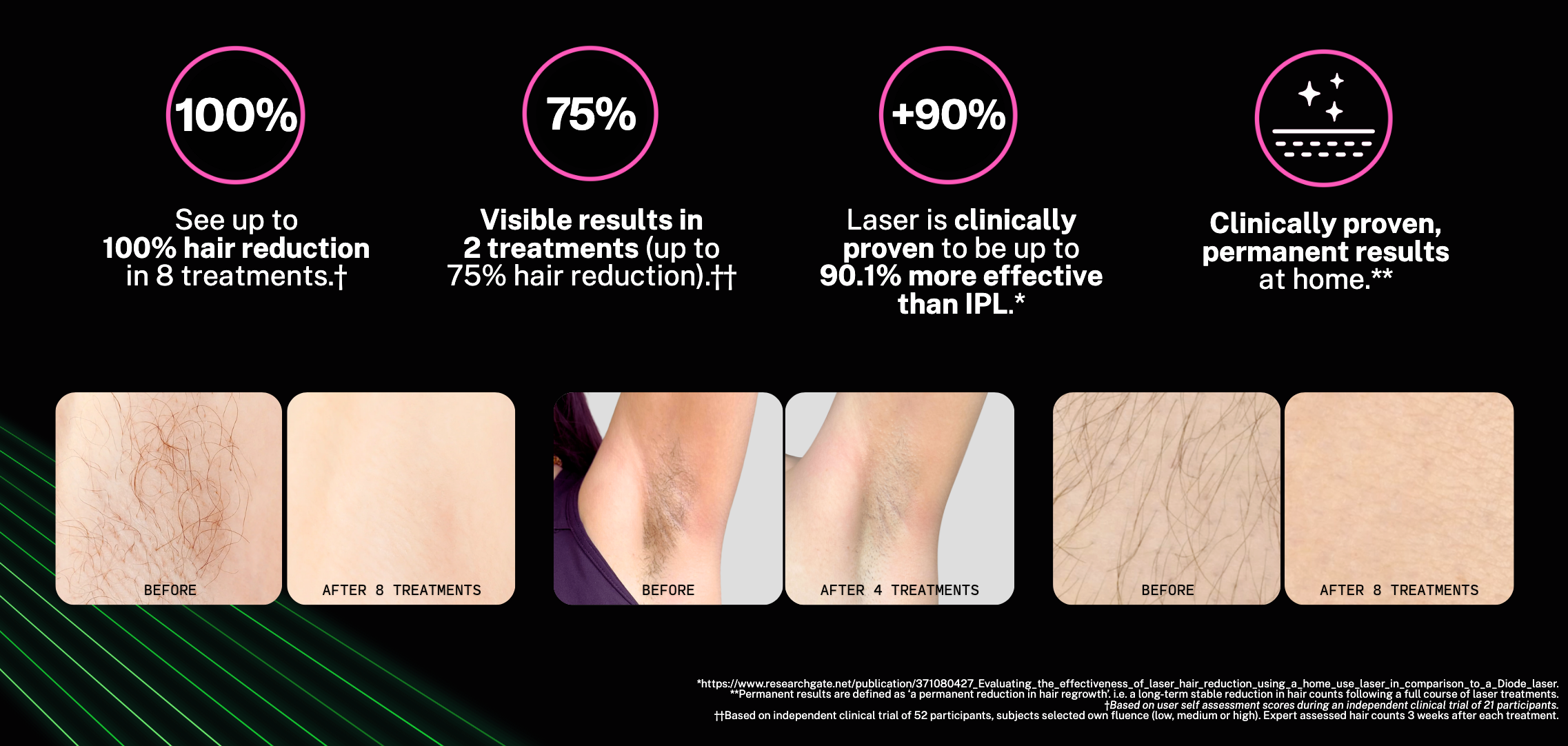 Tria 4X Laser Review
